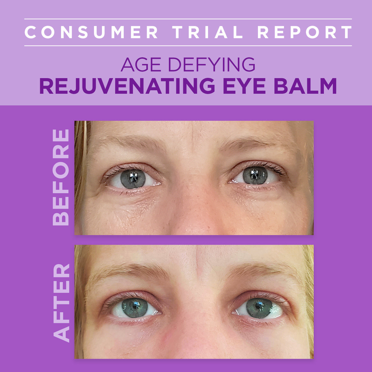 Age Defying Rejuvenating Plant-Based Retinol Alternative Eye Balm - Andalou Naturals US