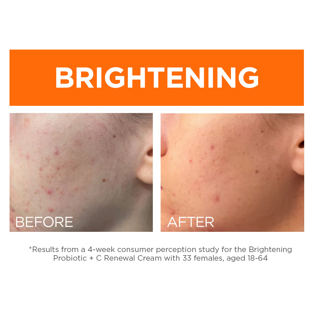 Brightening Probiotic + C Renewal Cream - Andalou Naturals US